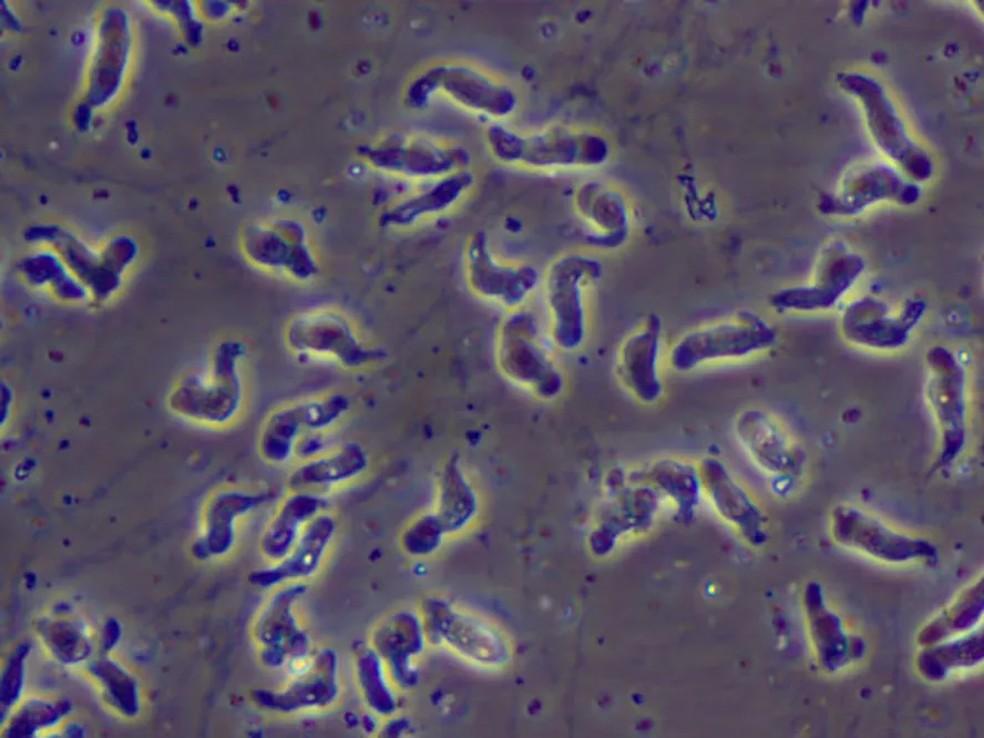 Naegleria fowleri, conhecida como 'comedora de cérebros'