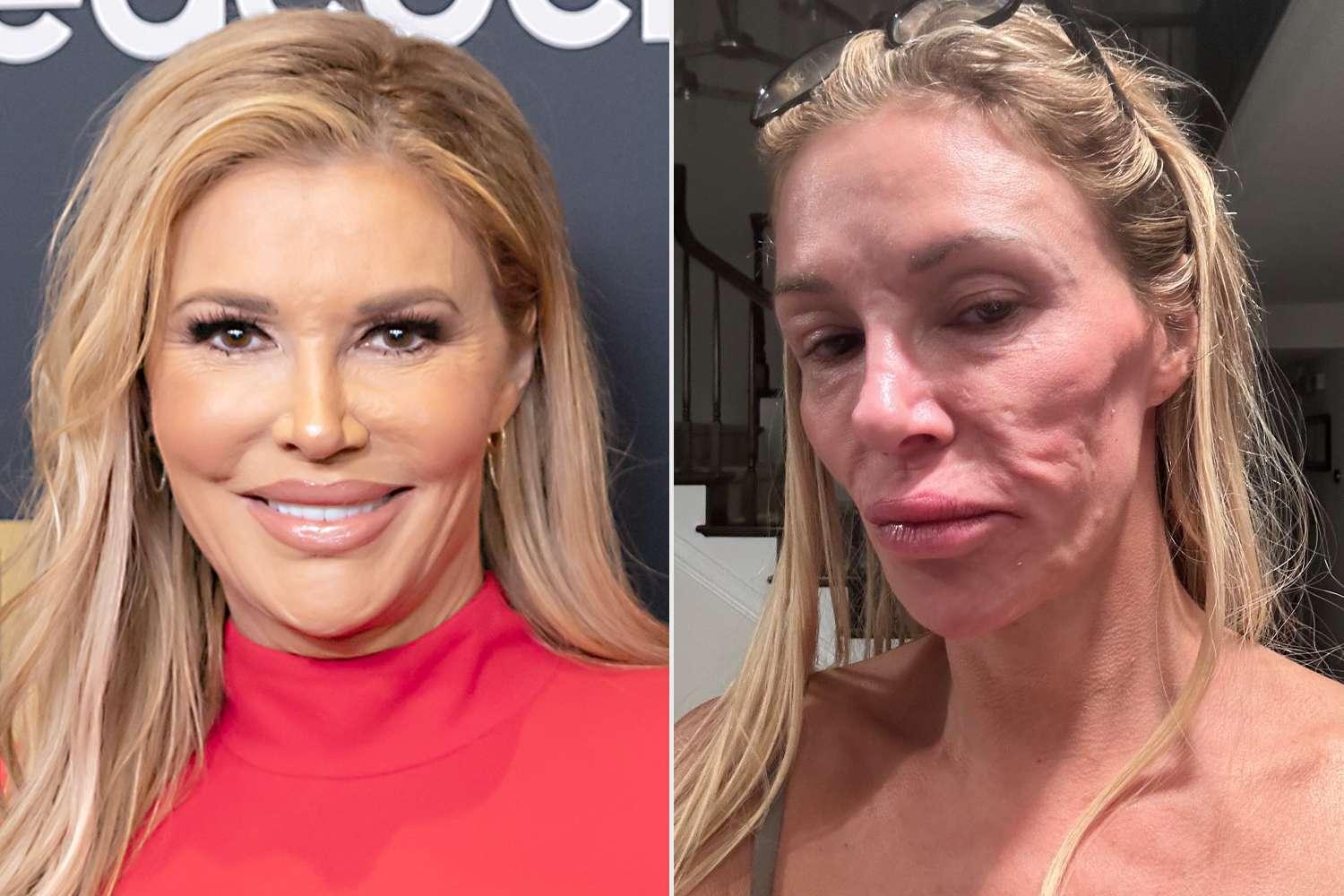 Brandi Glanville mostrando o impacto de um problema de saúde