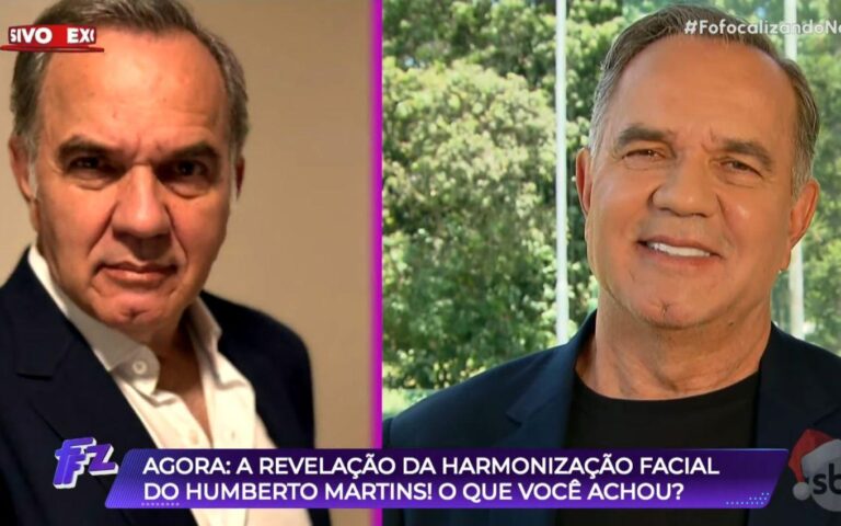 Humberto Martins surpreende com harmonização facial e revela detalhes da carreira