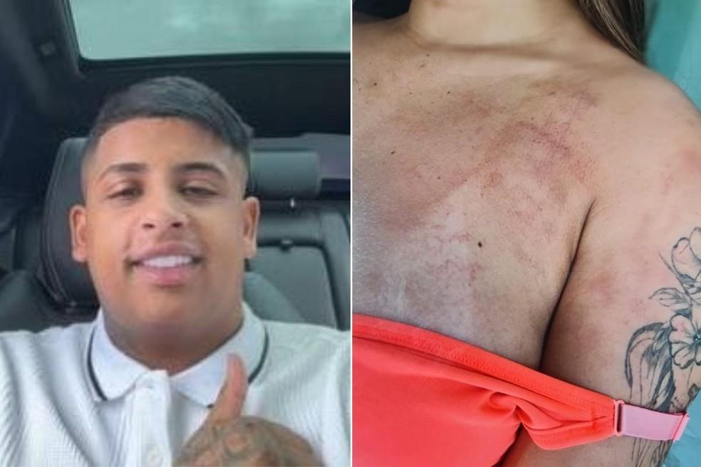 Mulher acusa Richard Henrique Julião de violência doméstica; homem é procurado por espancar idoso em Praia Grande, SP