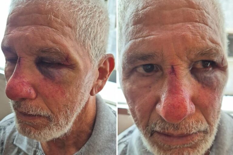 Motorista de Porsche é acusado de agredir ex-namorada e idoso em Praia Grande