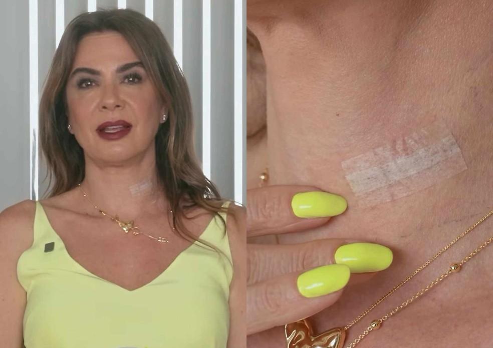 Luciana Gimenez mostra cicatriz de cirurgia na coluna