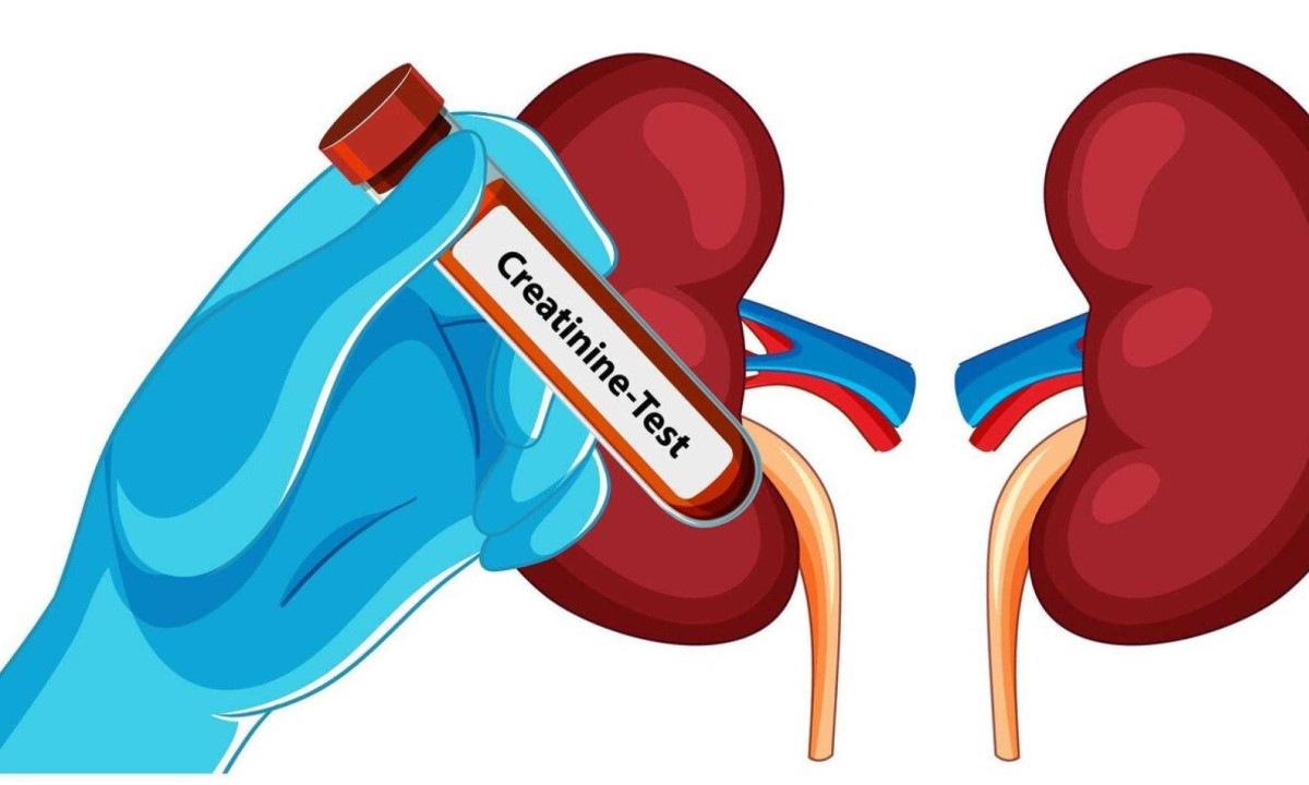 Os rins são responsáveis por funções vitais, como filtrar as toxinas do sangue e controlar a pressão arterial.