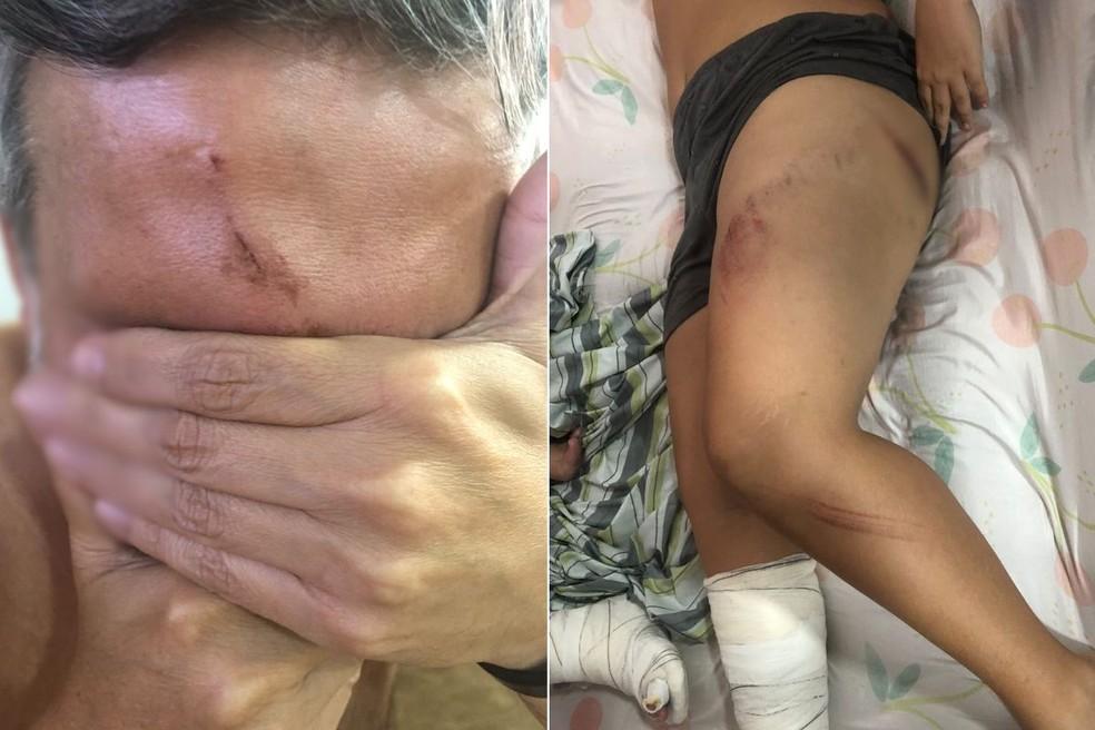 Pai e filho estão entre os turistas feridos em acidente que aconteceu em São Vicente
