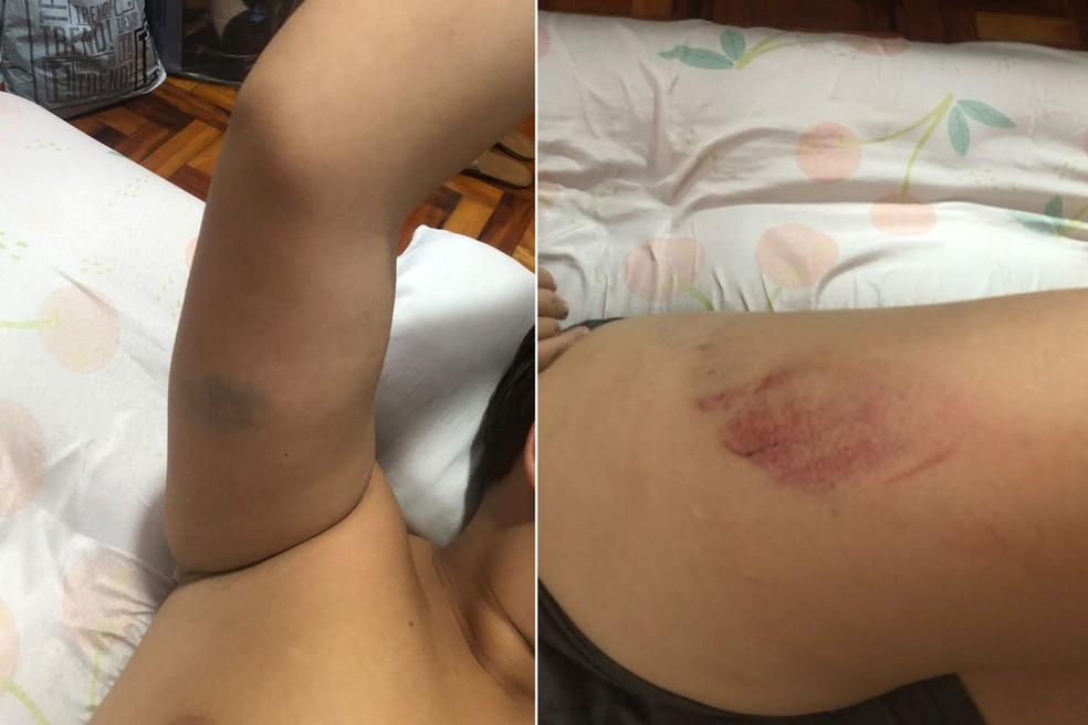 Adolescente apresentou torção no pé direito após acidente em São Vicente