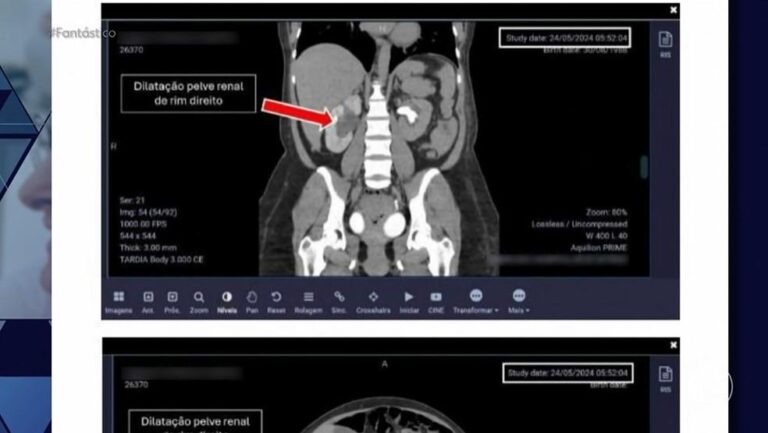Denúncias de Violência Obstétrica Repercutem Contra Médica Influencer no Brasil