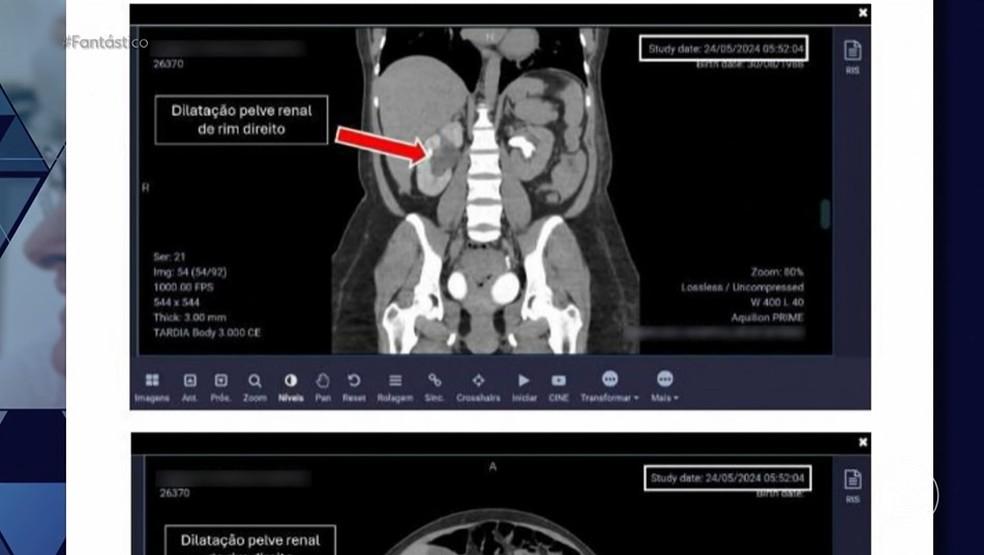 Mulheres relatam histórias de violência em partos realizados por médica influencer