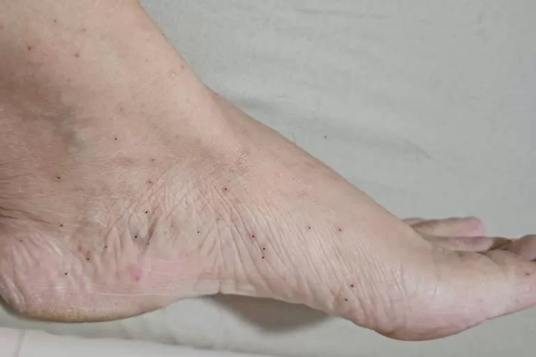 Infestação de Borrachudos Preocupa Moradores no Rio de Janeiro