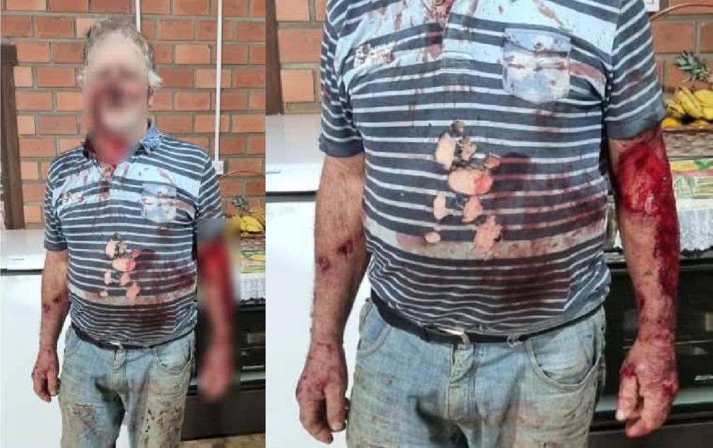 Agricultor sobrevive a ataque de leão baio no RS