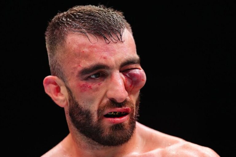 Mohammad Yahya sofre grave lesão e quebra recorde de knockdowns no UFC