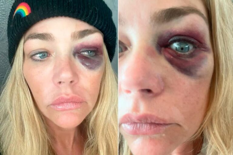 Denise Richards Denuncia Violência Doméstica e Acusa Ex-Marido de Agressões