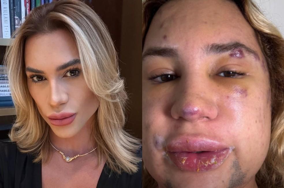 Junior Dutra teria morrido em decorrência de complicações após uma intervenção estética