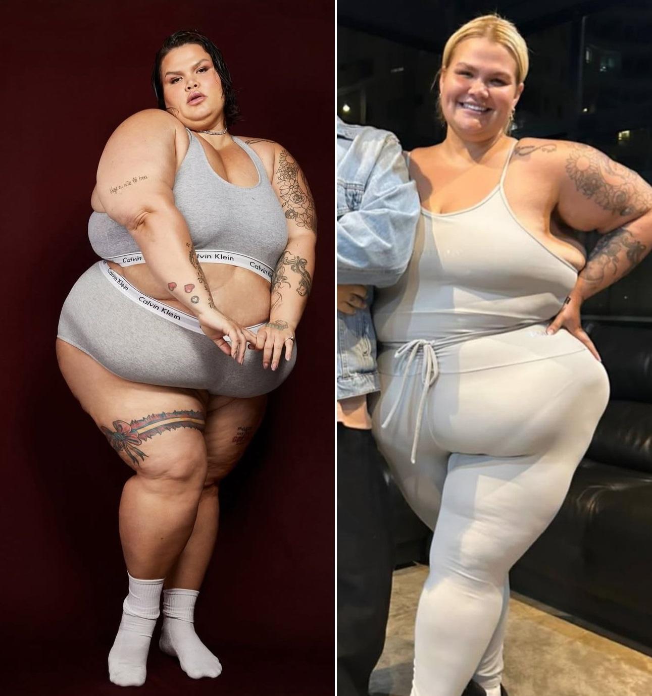 Thais Carla antes e depois da cirurgia bariátrica