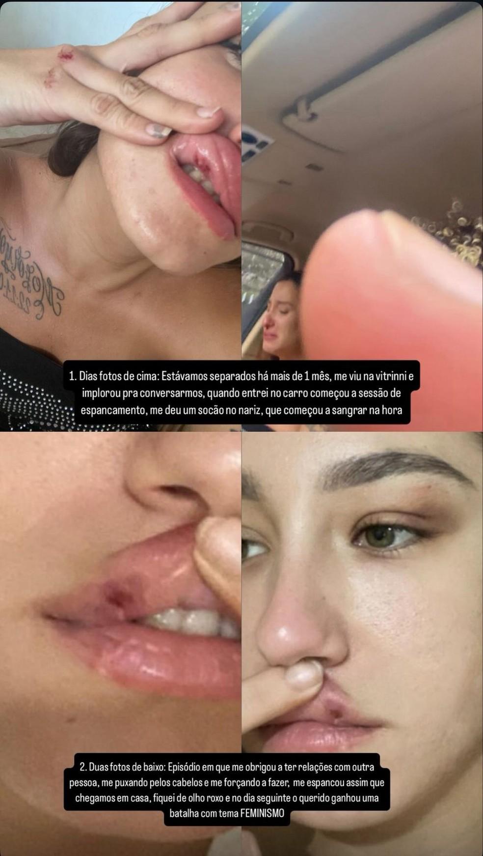 Agressões em Instagram