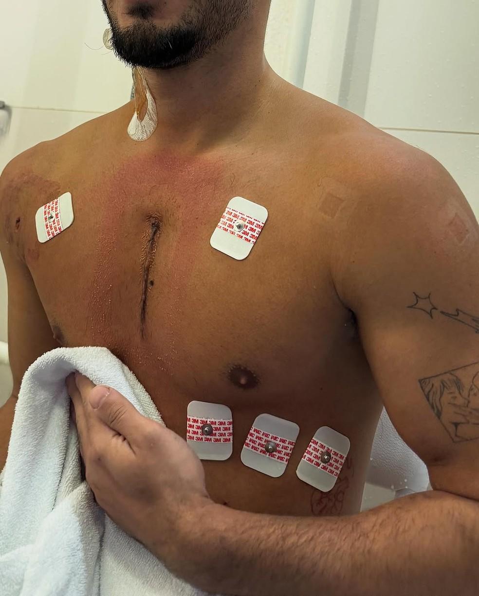 Vittor Fernando fala sobre ataque sofrido no Rio