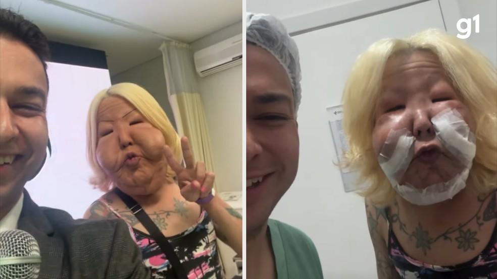 Antes e depois da primeira cirurgia de Juliana