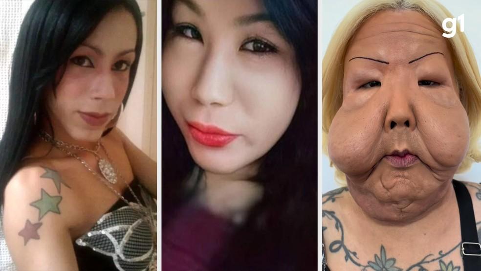 Juju do Pix antes da cirurgia