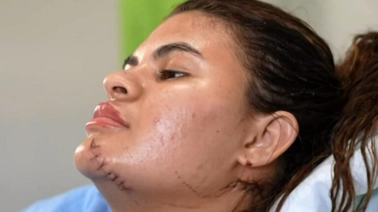 Jovem Ana Clara Finge de Morta em Terrível Ataque e Sobrevive a Tentativa de Feminicídio