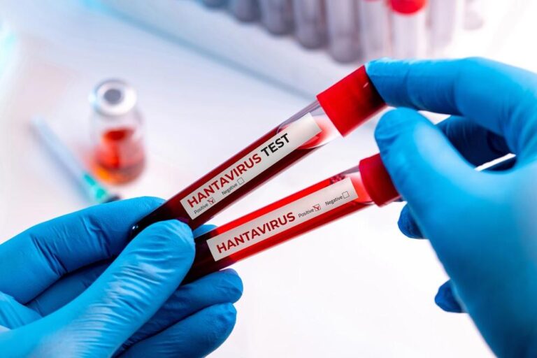 Paraná Confirma Casos de Hantavírus e Reforça Vigilância Sanitária