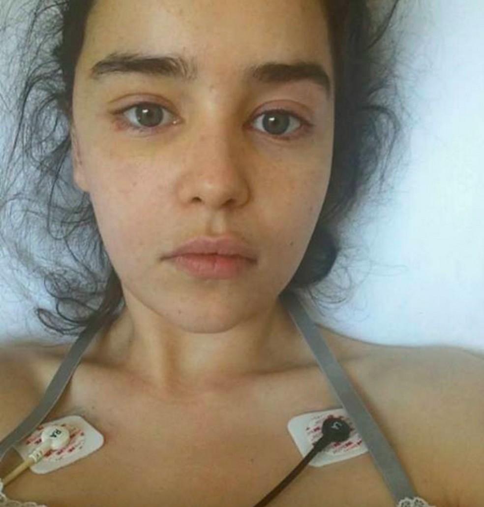 A atriz Emilia Clarke em seu leito hospitalar após sofrer uma série de aneurismas em 2011
