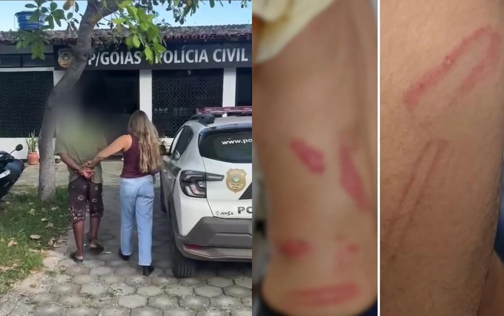 Suspeitos de agredir e sequestrar mulher trans são presos