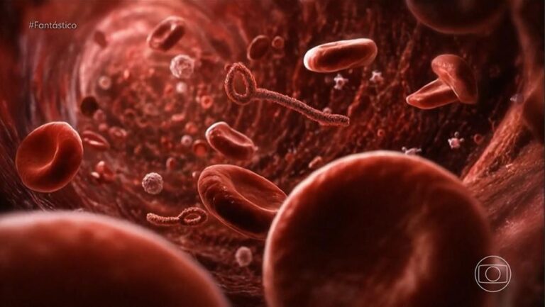 Ebola volta a assustar a África em meio à crise humanitária no Congo