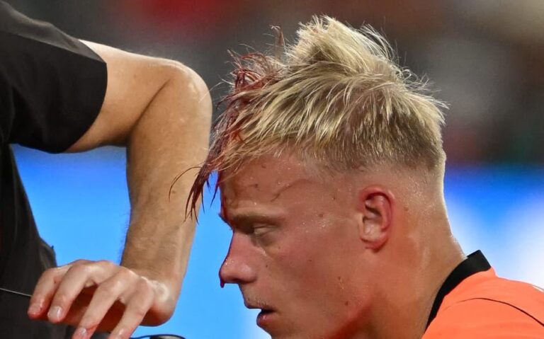 Cena Impactante na Copa do Mundo: Zagueiro Holandês Leva Joelhada e Sangra em Campo