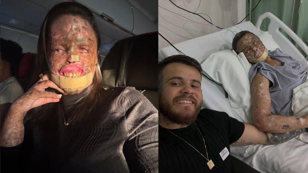 Káh Felipe: influencer compartilhava rotina de tratamento nas redes sociais